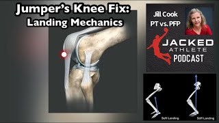 Jumper’s Knee Landing Mechanics Fix Patellar Tendon Pain [upl. by Briscoe4]