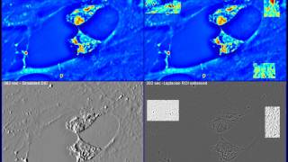 Microglial cell dynamics [upl. by Salesin564]