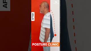 How to Improve your Posture Mission Health Posture Clinic  Kyphosis  Scoliosis  Flat Back [upl. by Kelby]