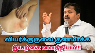 வியர்க்குரு குணமாக உடல் சூடு குறைய பாட்டி வைத்தியம்  DrSivaraman speech on heat rash remedy [upl. by Enirehtak528]