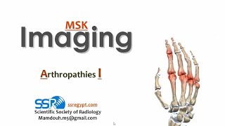 05 Joint disease arthropathy I TEC Prof Mamdouh Mahfouz [upl. by Elawalo467]