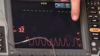 Waveform Capnography [upl. by Adelind]