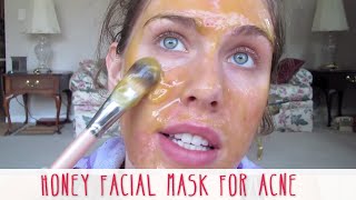 Homemade Honey Facial Mask For Acne  Cassandra Bankson [upl. by Ilatfen]