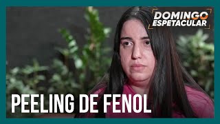 Exclusivo Domingo Espetacular fala com esteticista que aplicou peeling de fenol em empresário [upl. by Annadroj428]