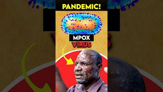 ALERT New PANDEMIC is Spreading Across The World  MPOX Virus Explained [upl. by Gayel]