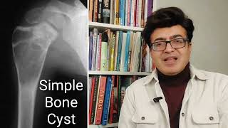 Review of simple bone cyst Radiology Xrays and CT images [upl. by Marguerita]