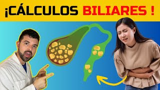 CÓLICO BILIAR dolor por PIEDRAS en la VESICULA [upl. by Cargian520]