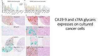 sTRA amp CA199 glycans express on cultured pancreatic cancer cells Code 696 [upl. by Eidod795]