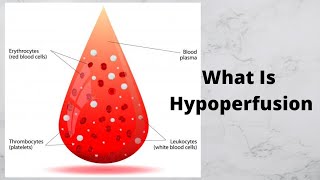 What Is Hypoperfusion [upl. by Zizaludba]