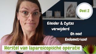 Eierstok cystes  eileider verwijderd amp ENDOMETRIOSE 😱 Mijn ervaringsverhaal [upl. by Wiltsey]