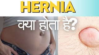 Hernia kya hota hai  causes of hernia  हर्निया क्या है  हर्निया का कारण [upl. by Jamey]