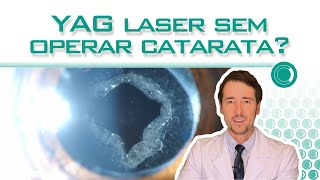 YAG laser sem operar catarata [upl. by Sitoel]