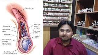 4 Best Homeopathic Medicine for Hydrocele  Treatment in Homeopathy without Surgery [upl. by Dominy]