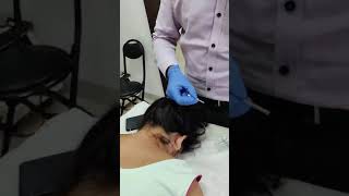 Needling Therapy for neck pain cervical pain shoulder pain [upl. by Margit]