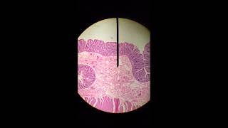 Large IntestineColon  Histology [upl. by Aisa]