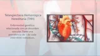 THH Telangiectasia Hemorrágica Hereditaria  Diagnóstico Genético  Secugen [upl. by Genet144]