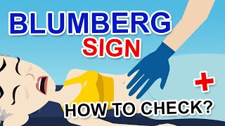 BLUMBERG SIGN [upl. by Llennoj]