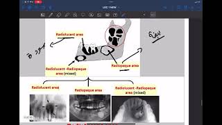 introduction of oral pathology part 4 [upl. by Ellohcin]