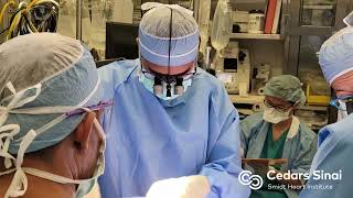 Case Numbers  CedarsSinai Thoracic Surgery—Integrated Residency [upl. by Ahtaga]