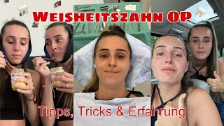 Weisheitszahn OP  Tipps Tricks amp Erfahrung lokale Betäubung  lesotwins 👯‍♀️ [upl. by Carlos]