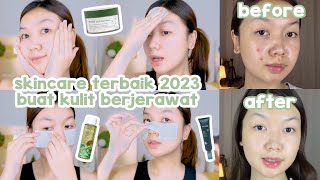 Skincare Terbaik 2023 Untuk Kulit Berjerawat  Desty Yufenti [upl. by Mcmurry]