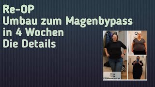 Schlauchmagen Umbau zum Magenbypass alle Details Magenbypass umbauschlauchmagen [upl. by Annekim]