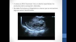 ULTRASONIDO EN OBSTETRICIA II [upl. by Ricardama]