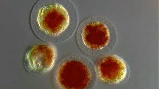 Haematococcus pluvialis Blutregenalge [upl. by Standing656]