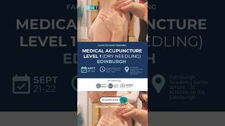 Back Pain Relief using Medical Acupuncture dry needling osteopathy backpain [upl. by Anahsohs]