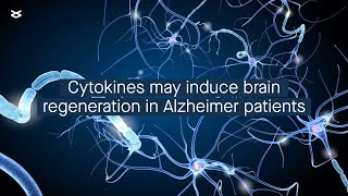 Cytokineinduced neurogenesis improved cognitive function in a patient with Alzheimer’s disease [upl. by Kayla476]