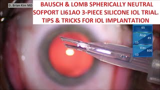 Bausch amp Lomb Sofport LI61AO Trial Tips amp Tricks for Easy amp Consistent IOL Implantation [upl. by Jobey455]