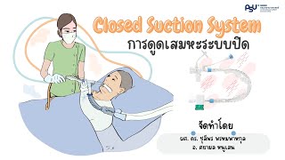 Closed Suction System การดูดเสมหะระบบปิดในผู้ใหญ่ที่ใส่ท่อช่วยหายใจ [upl. by Ramel]