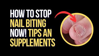 How to STOP Nail Biting  Tips and Supplements [upl. by Orhtej]