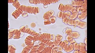 Red blood cells under the microscope 2000X [upl. by Cirek]