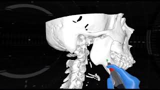 Virtual Reality in Oral and Maxillofacial Surgery [upl. by Hollister]