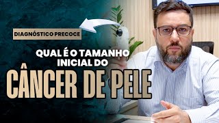 QUAL É O TAMANHO INICIAL DO CÂNCER DE PELE MÉDICO REVELA A VERDADE SOBRE O CARCINOMA BASOCELULAR [upl. by Artur]