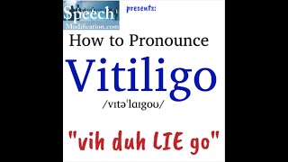 How to Pronounce Vitiligo [upl. by Euqinim]