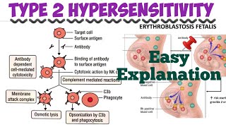 Type 2 Hypersensitivity  types of hypersensitivityimmunology 😎🤩 [upl. by Brody400]