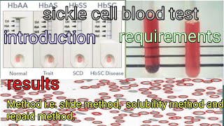 sickle or sickling disease or cell anemia test [upl. by Freemon396]