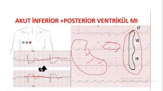 SINAVLARDA EKG [upl. by Olim]