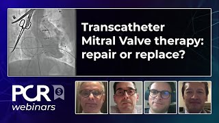 Transcatheter Mitral Valve therapy  repair or replace  Webinar [upl. by Wainwright38]