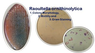 Raoultella ornithinolytica Colony Morphology Motility and Gram Staining [upl. by Farrow928]