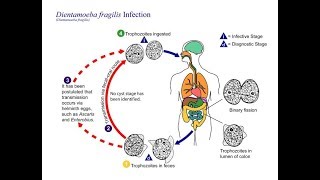 Dientamoeba fragilis ‘The unflagellated human flagellate’ [upl. by Lanahtan]