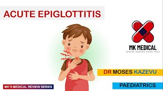 Acute Epiglottitis [upl. by Arit720]