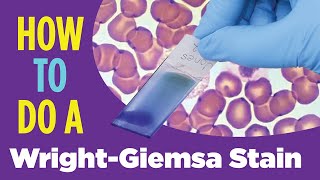 How to do a hematology stain WrightGiemsa stain Laboratory Tutorial Procedure [upl. by Perot]