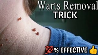 Warts removal trick 100�fective viralvideo Trending ABCHTN official [upl. by Adnolahs]