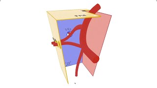 Pterygopalatine Fossa  Anatomy Contents and Borders [upl. by Kepner106]