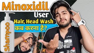 Minoxidil Users Shampoo Guidance  How To Use Shampoo Minoxidil Users [upl. by Airtened]