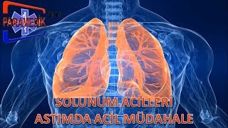 SOLUNUM Acilleri  Astım Krizinde Acil Müdehale Nasıl Olmalıdır [upl. by Lebasiram]