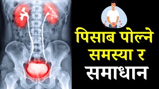 पिसाब किन पोल्छ  कारण र घरेलु समाधानका उपाय  Why does urine burn Causes and home remedies [upl. by Chura]